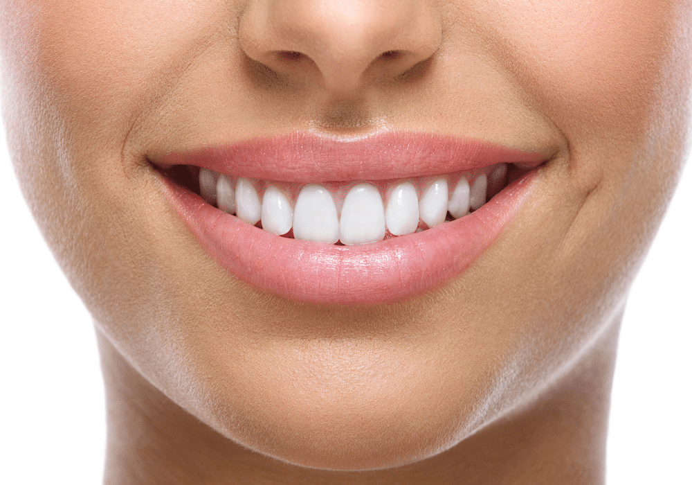 The_Essentials_of_a_Professional_Teeth_Cleaning_638526597233565696.png_-_Closeup of smile with white heatlhy teeth__